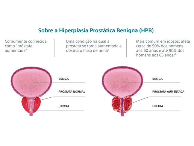 Conheça mais sobre a HPB e Rezūm™